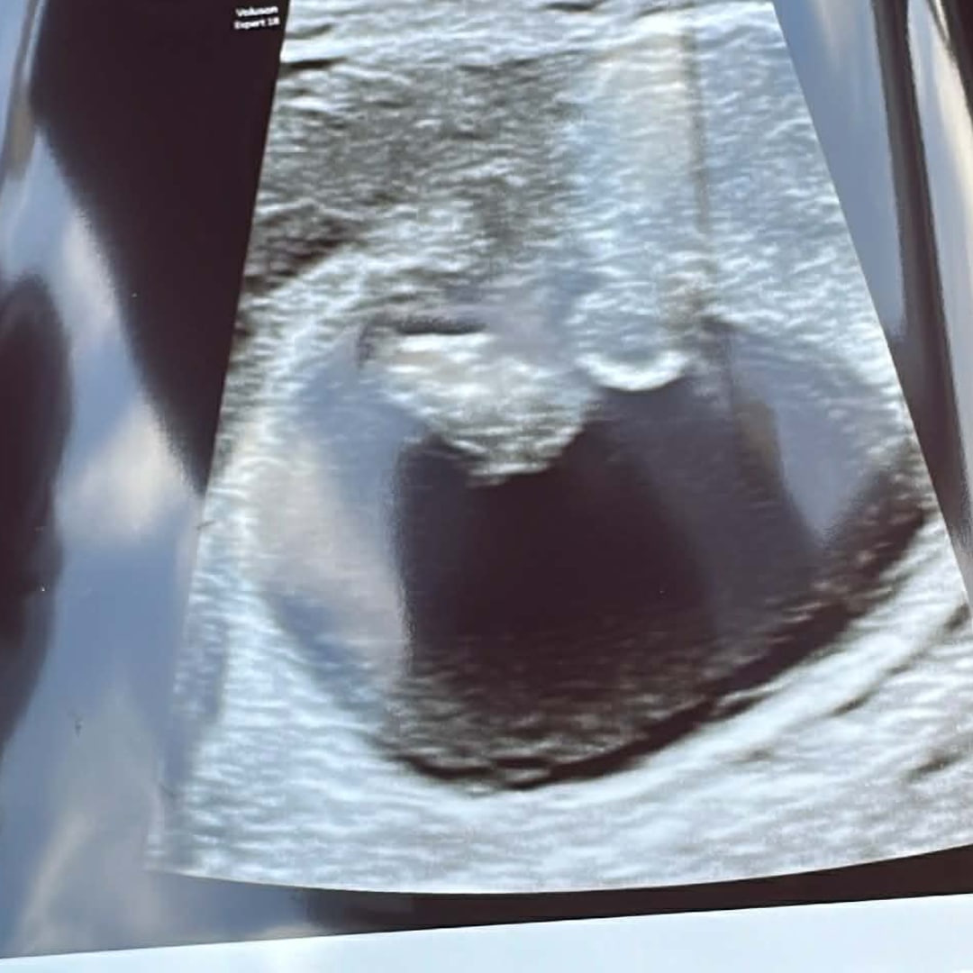 Photo shared by Jennie for their Babylist baby registry.