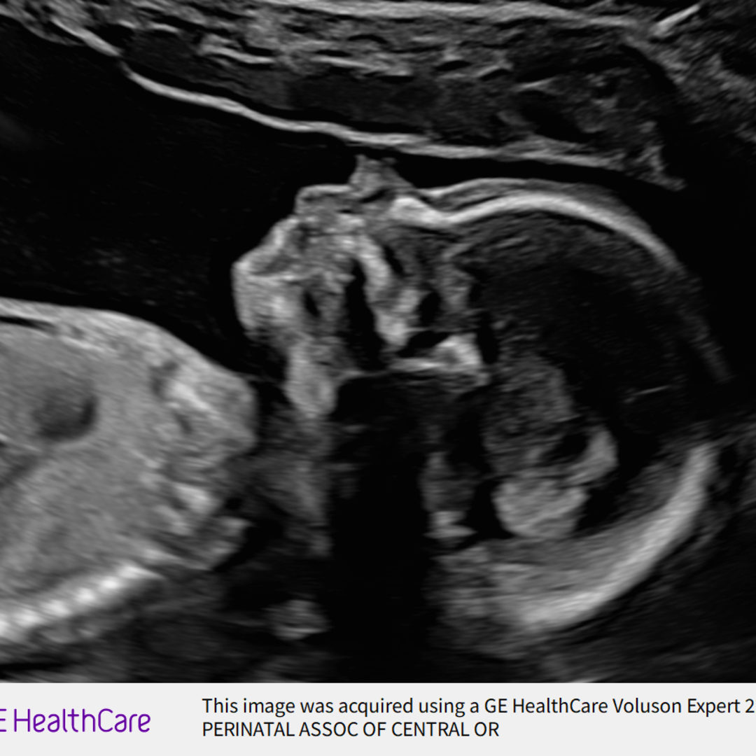 Photo shared by Cecily for their Babylist baby registry.