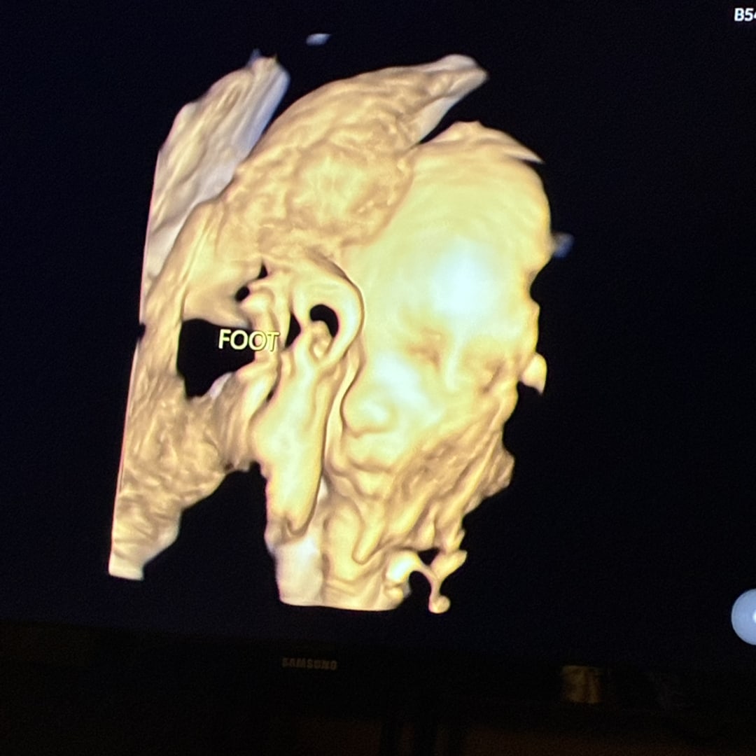 Photo shared by Leah for their Babylist baby registry.