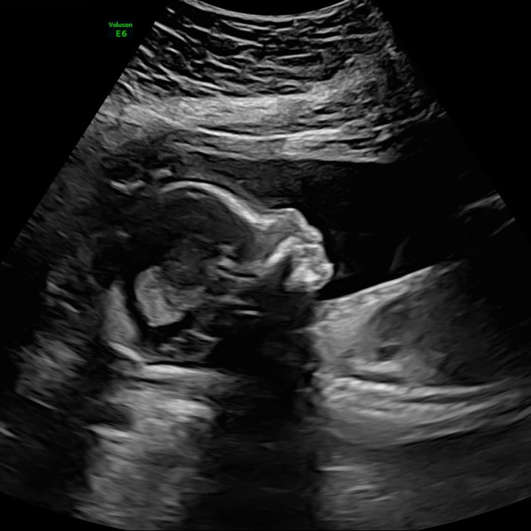 Photo shared by Hannah for their Babylist baby registry.