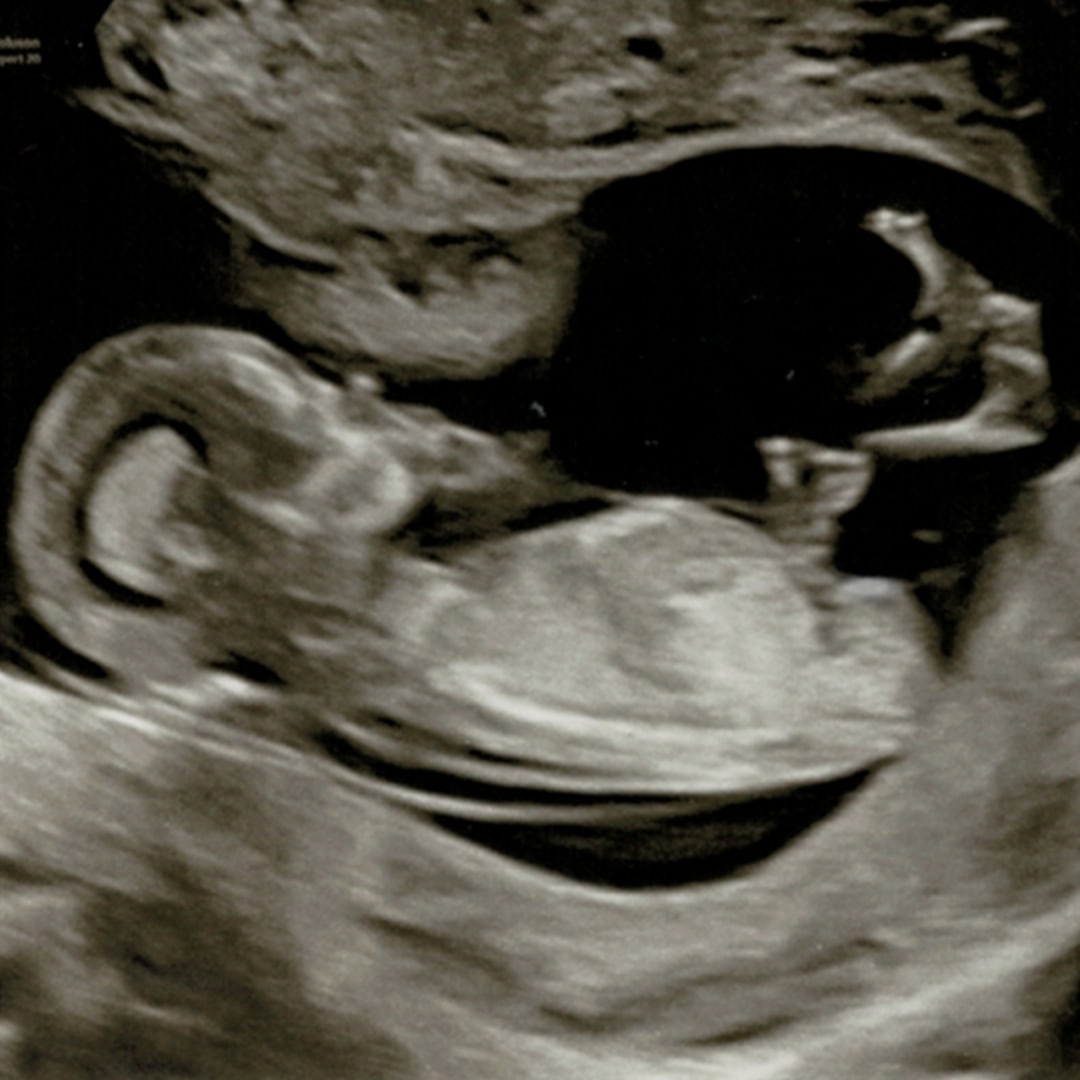 Photo shared by Denise for their Babylist baby registry.