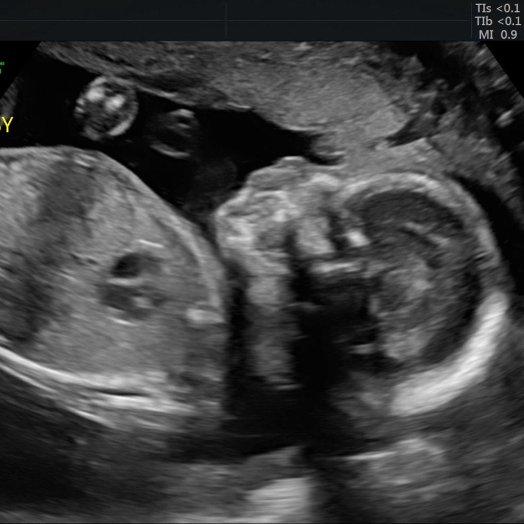 Photo shared by Horiana for their Babylist baby registry.