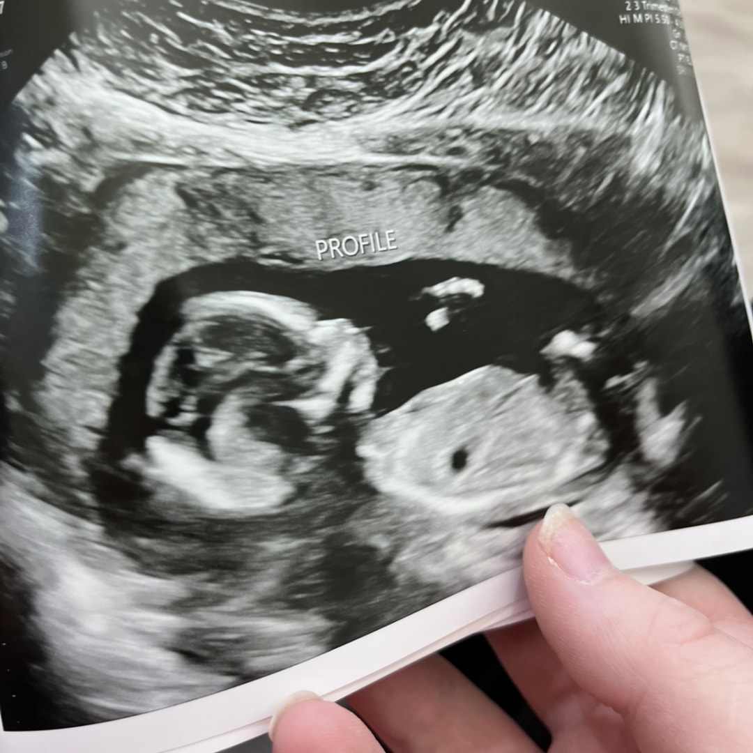 Photo shared by Bentley for their Babylist baby registry.