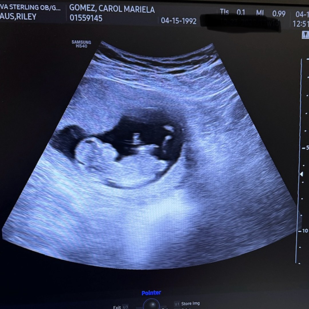 Photo shared by Carol for their Babylist baby registry.