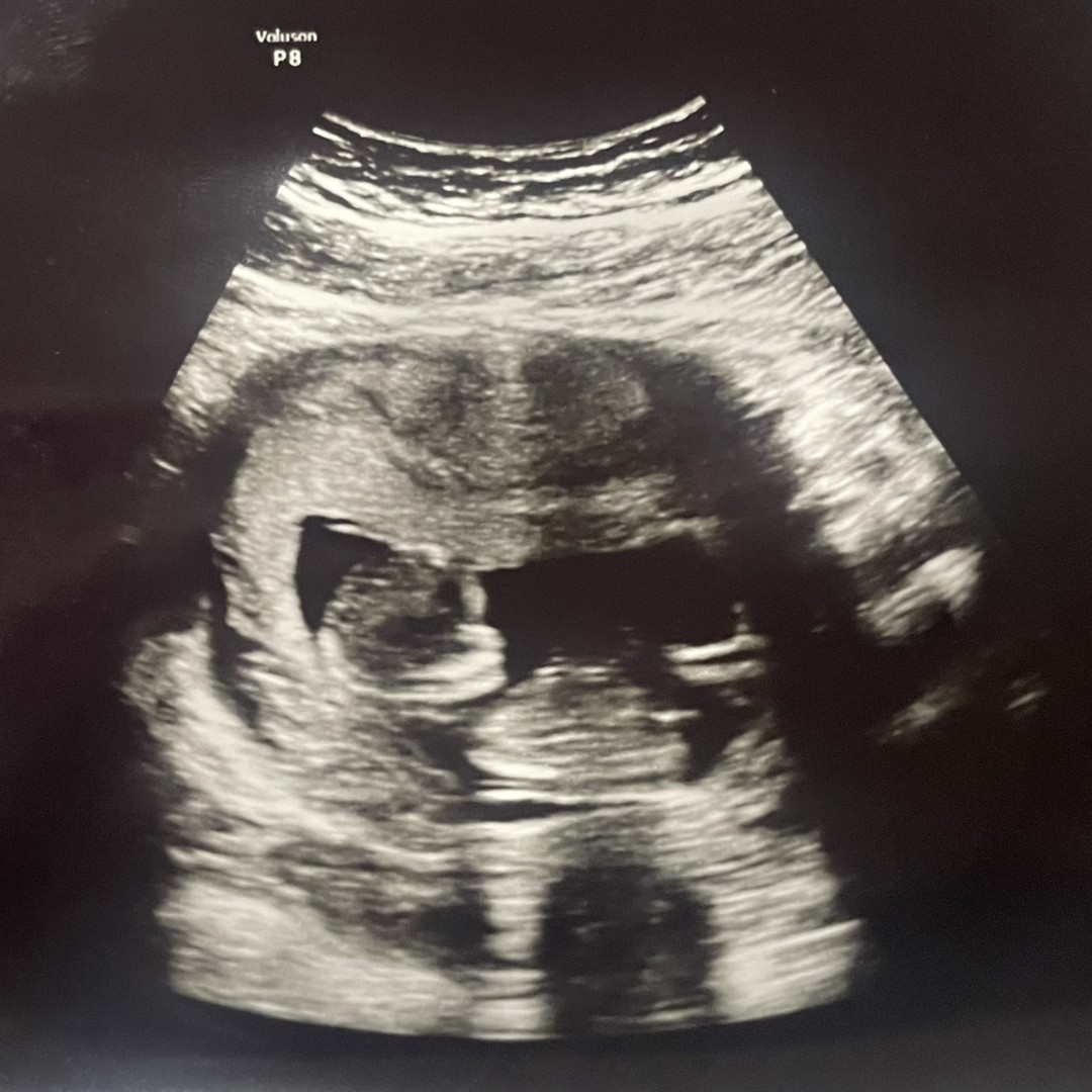 Photo shared by Aleigha for their Babylist baby registry.