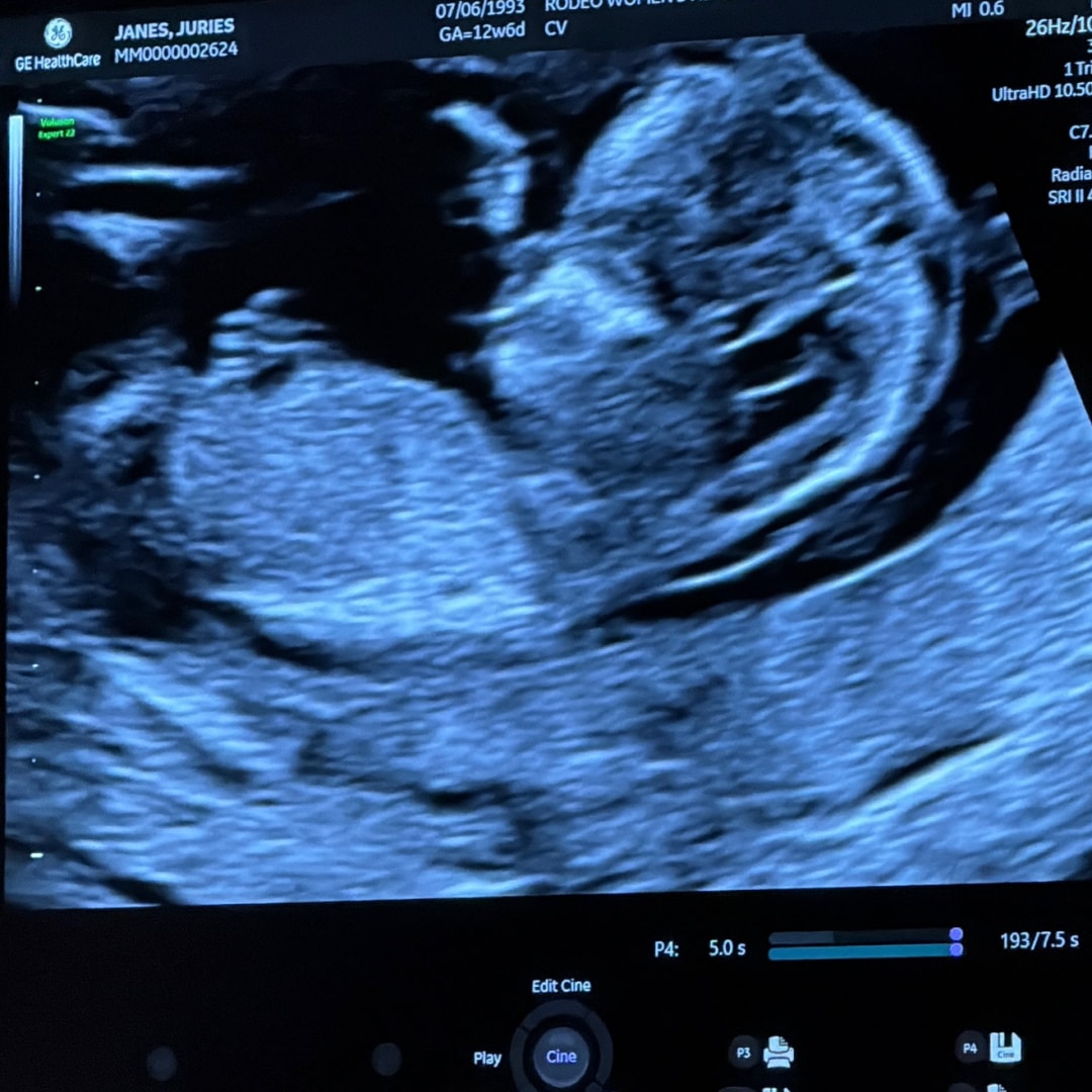 Photo shared by Juries for their Babylist baby registry.