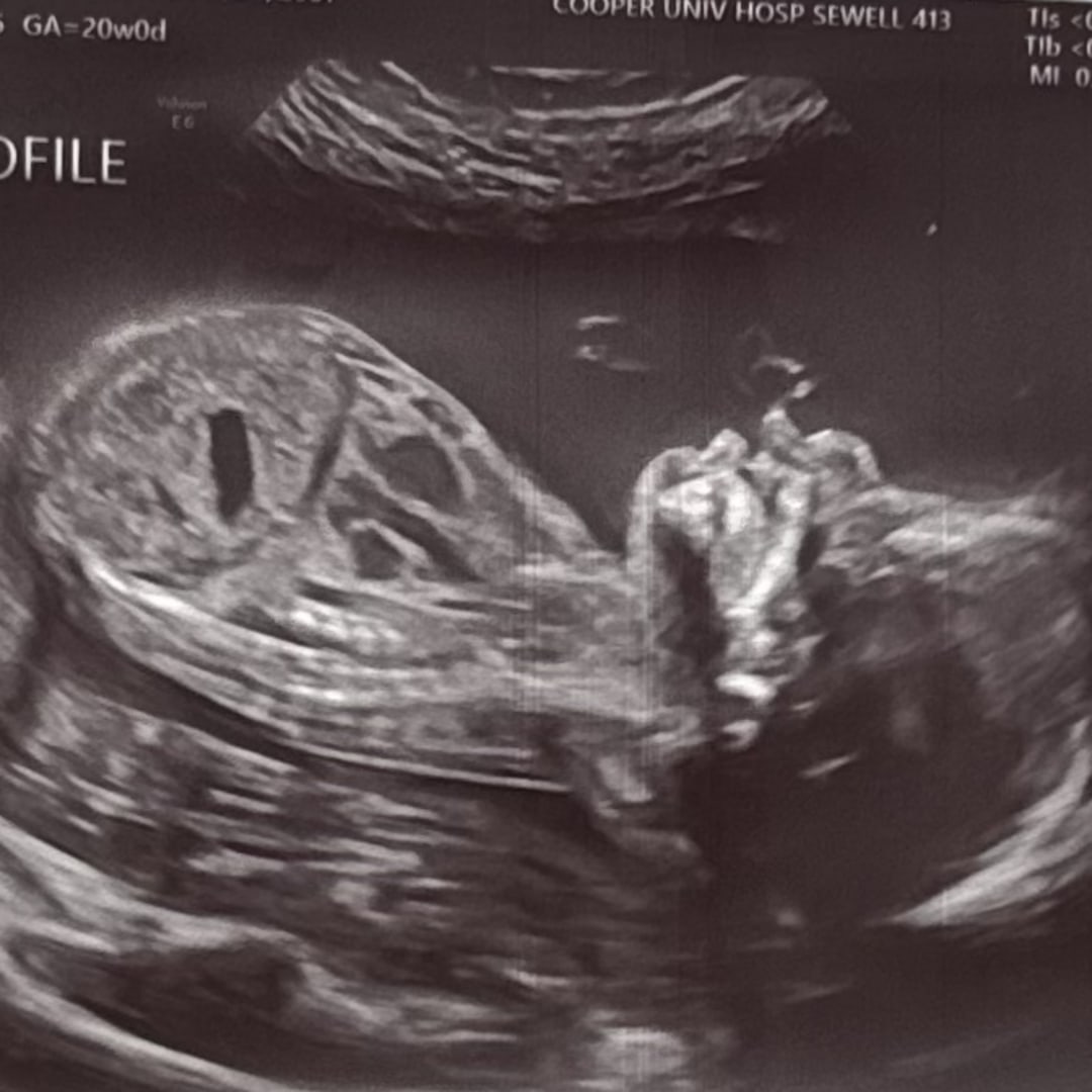 Photo shared by Angellynn for their Babylist baby registry.