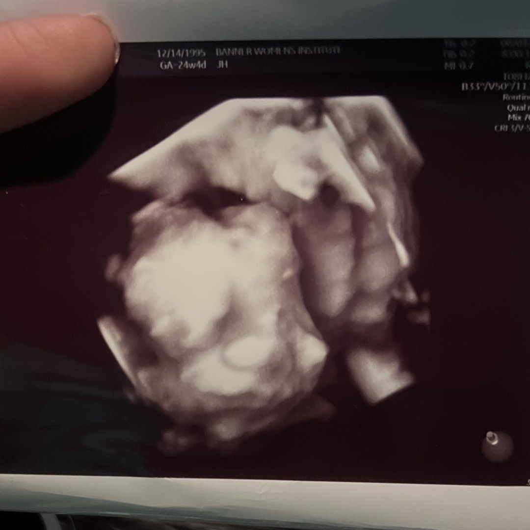 Photo shared by Jasmin for their Babylist baby registry.