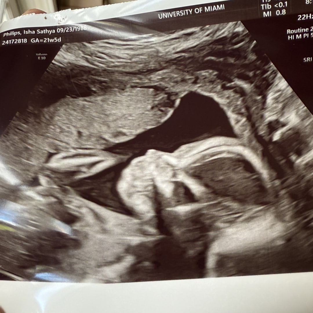 Photo shared by Suraj & Isha for their Babylist baby registry.