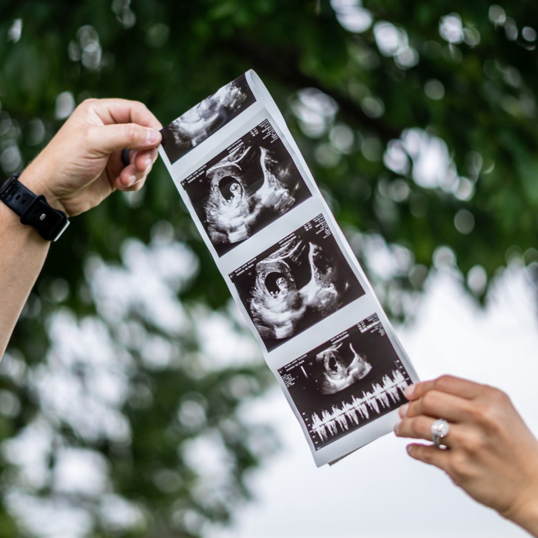 Photo shared by Laura for their Babylist baby registry.