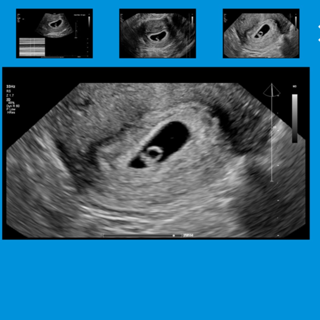 Photo shared by Sarah for their Babylist baby registry.