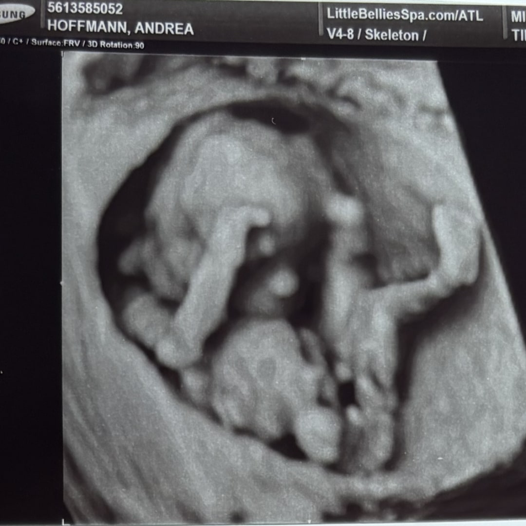 Photo shared by Andrea for their Babylist baby registry.