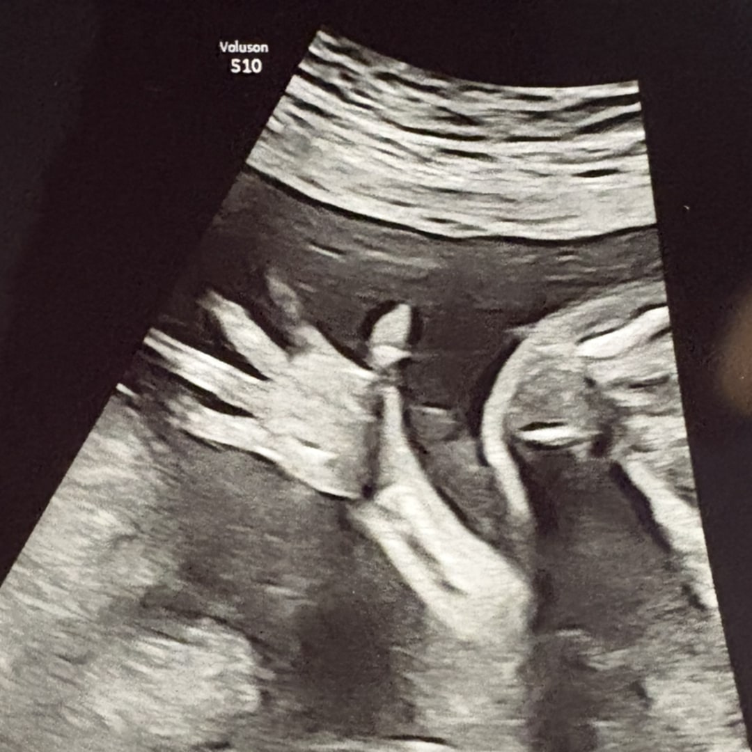 Photo shared by Cristina for their Babylist baby registry.