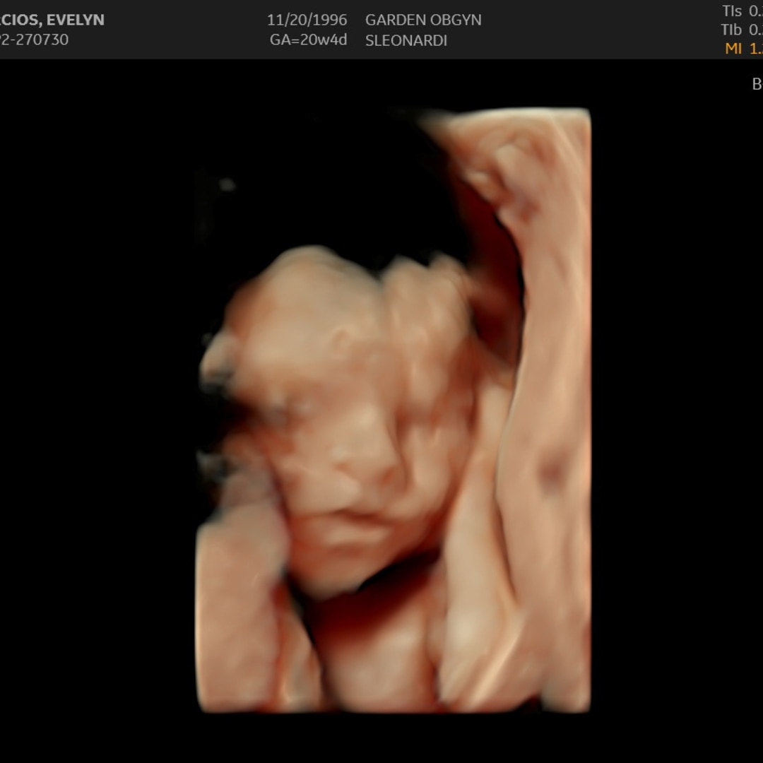 Photo shared by Evelyn for their Babylist baby registry.