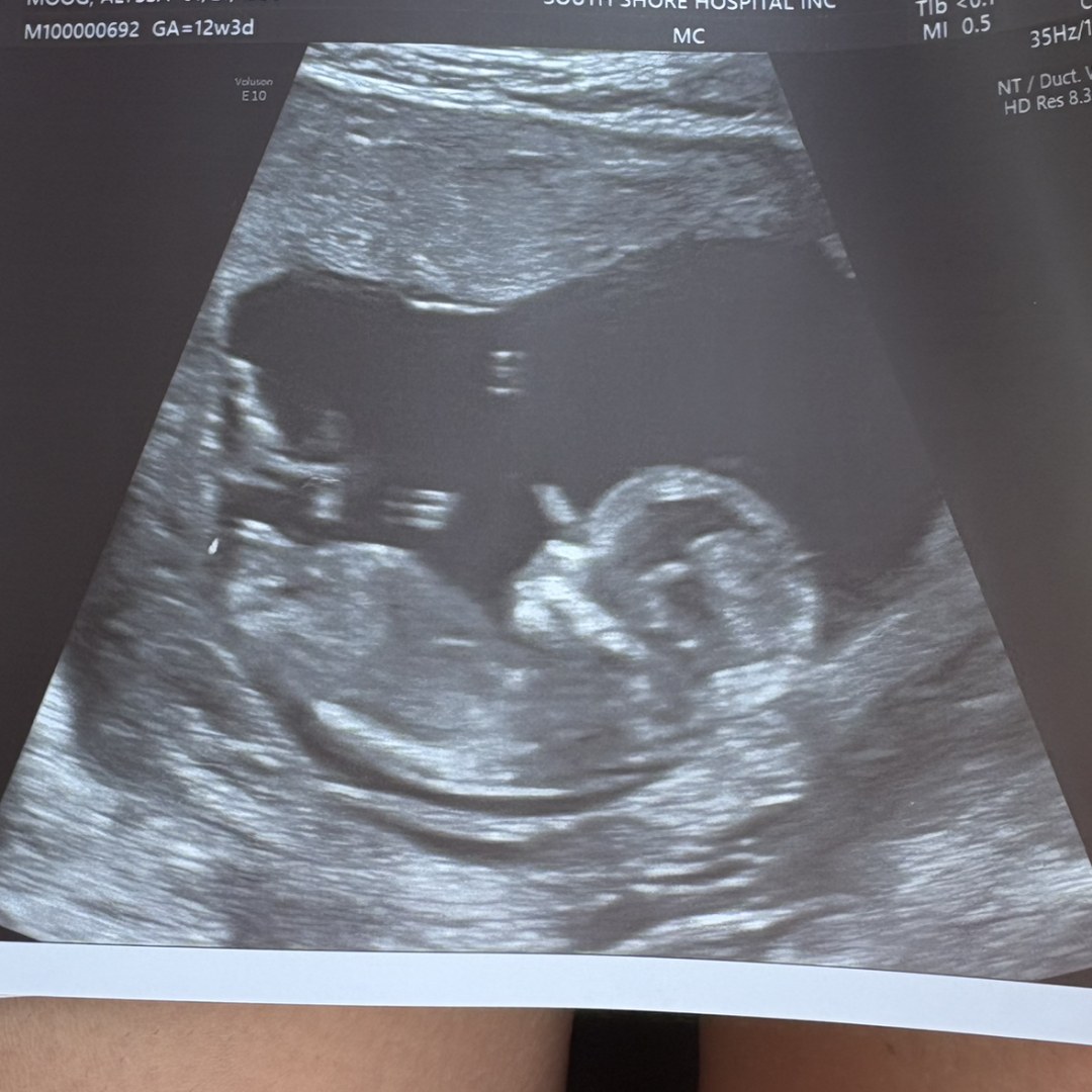 Photo shared by Alyssa for their Babylist baby registry.