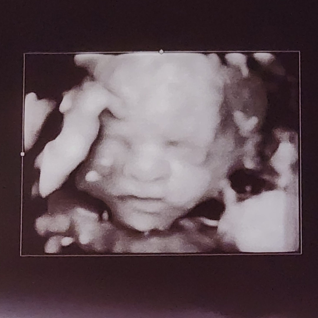 Photo shared by SANDRA for their Babylist baby registry.