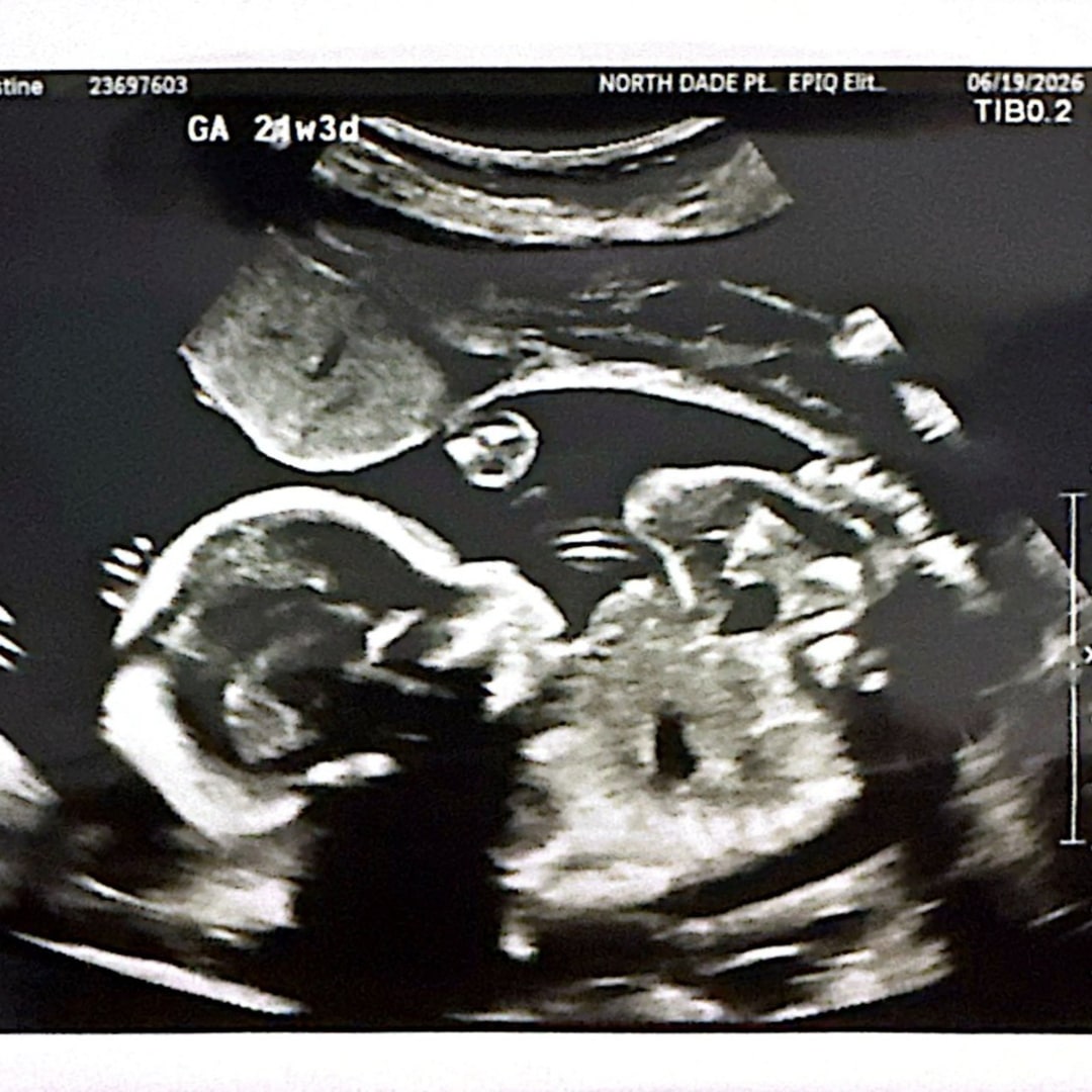 Photo shared by Christine for their Babylist baby registry.