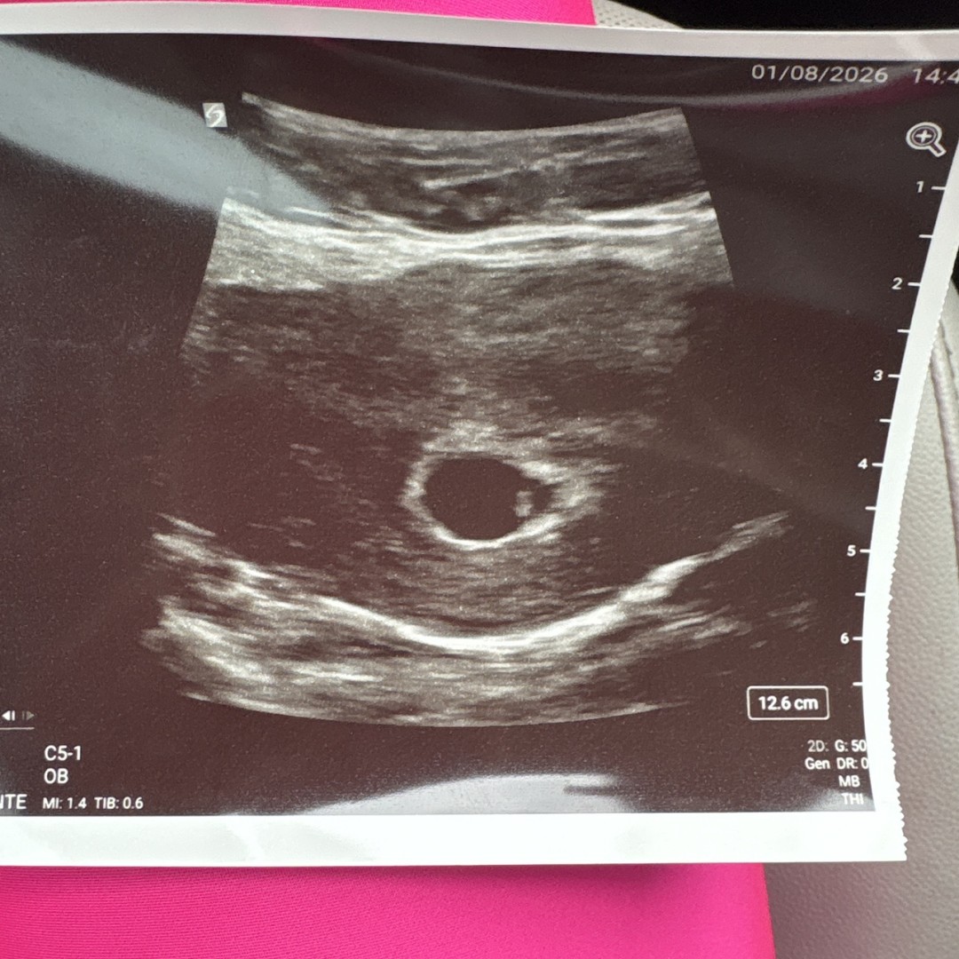 Photo shared by Brennyn for their Babylist baby registry.