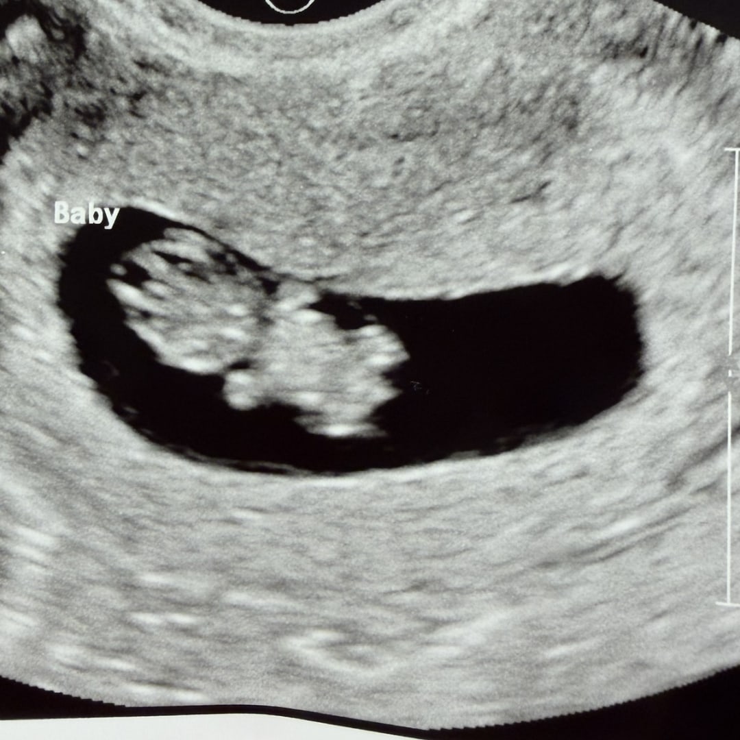 Photo shared by Emily for their Babylist baby registry.