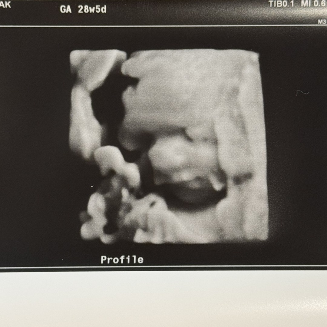 Photo shared by Breanna for their Babylist baby registry.