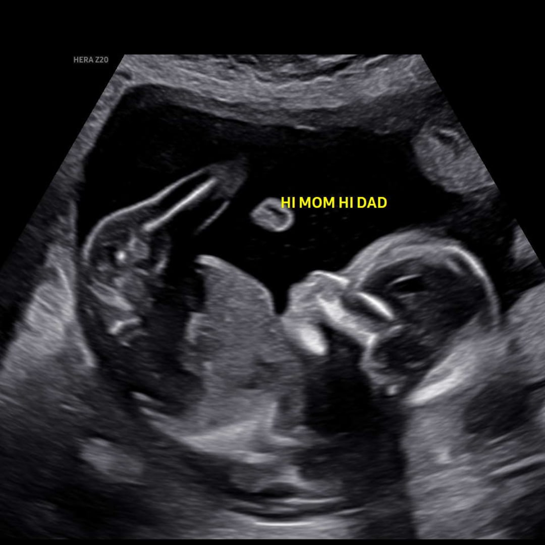 Photo shared by Kaitlyn for their Babylist baby registry.