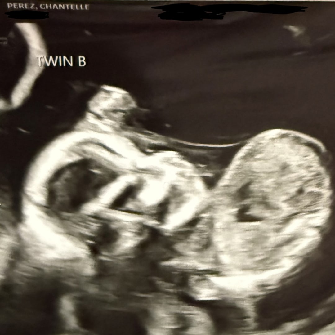 Photo shared by Chantelle for their Babylist baby registry.