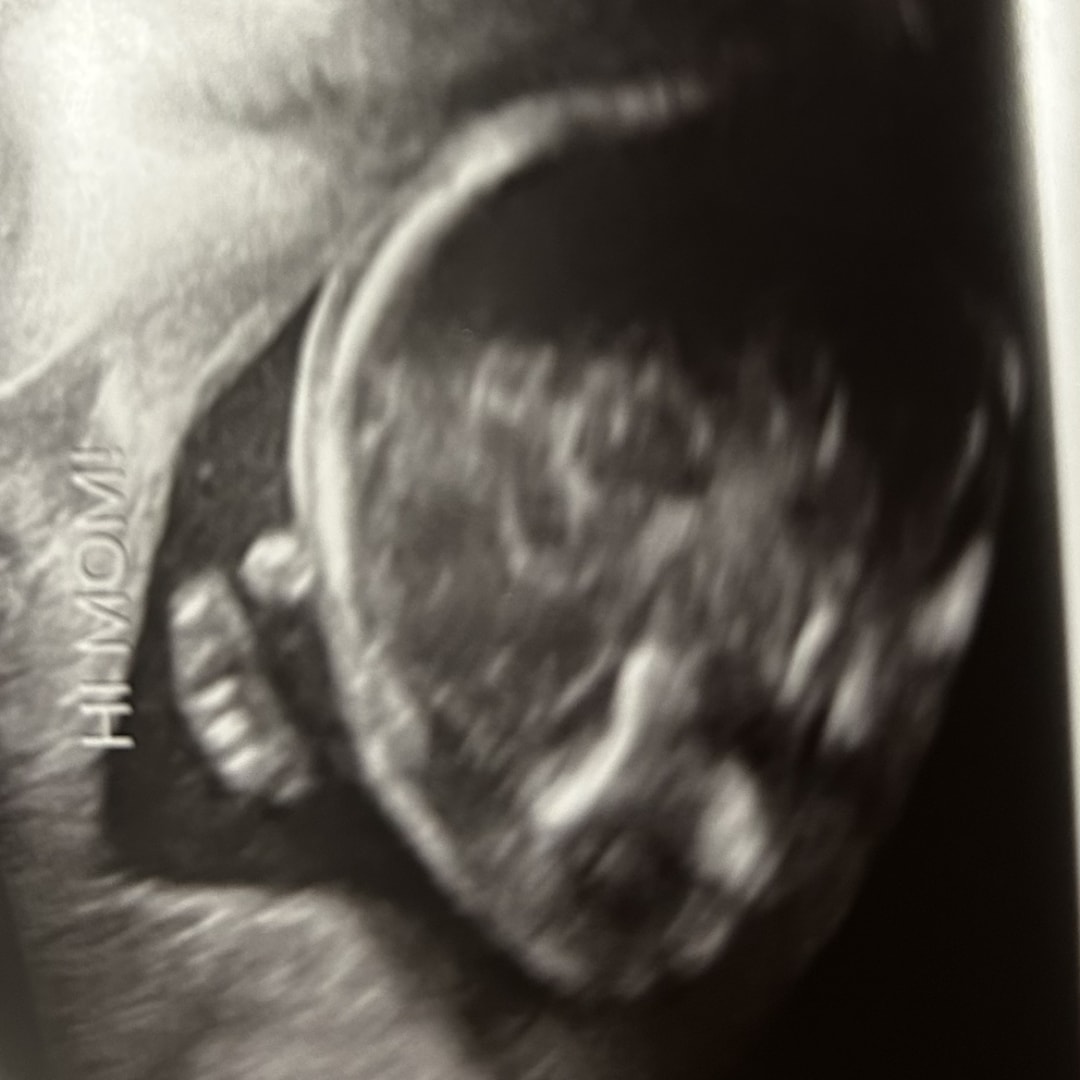 Photo shared by Monica for their Babylist baby registry.