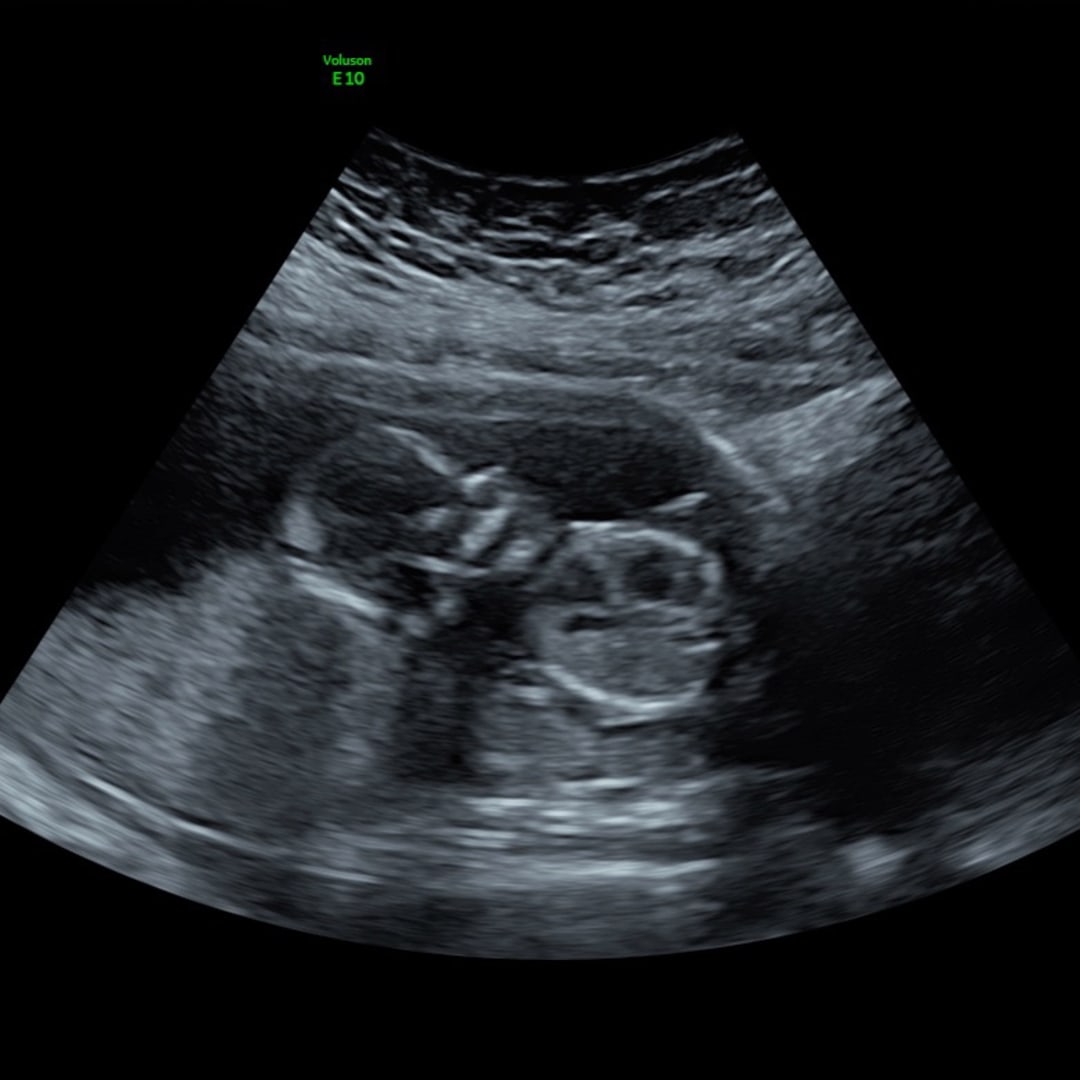 Photo shared by Corrine for their Babylist baby registry.