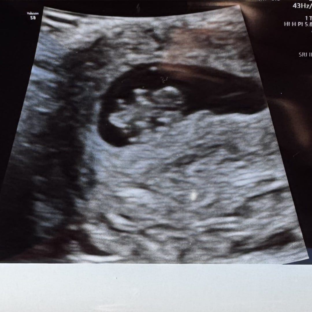 Photo shared by Jaiden for their Babylist baby registry.