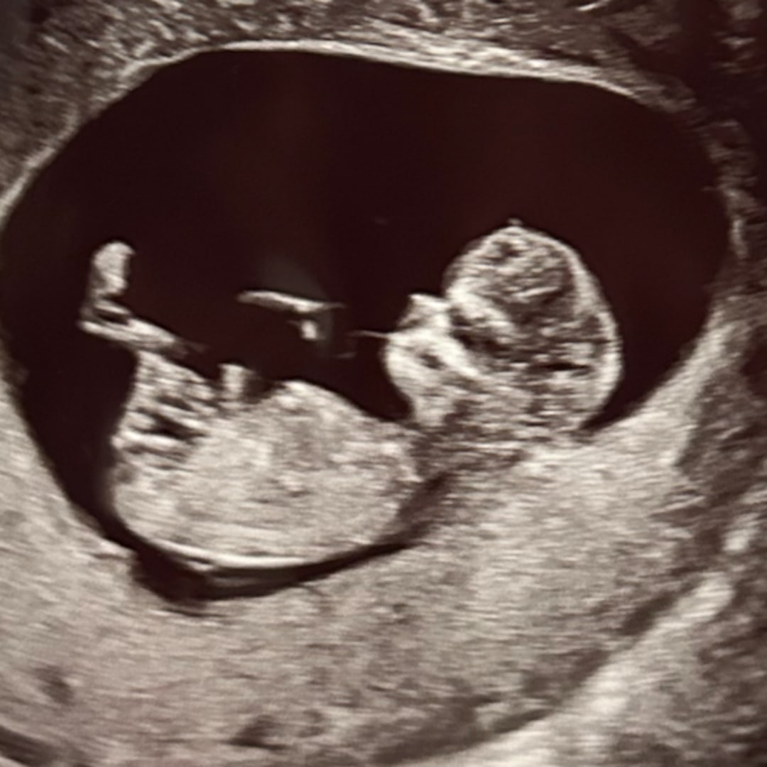 Photo shared by Sydney for their Babylist baby registry.