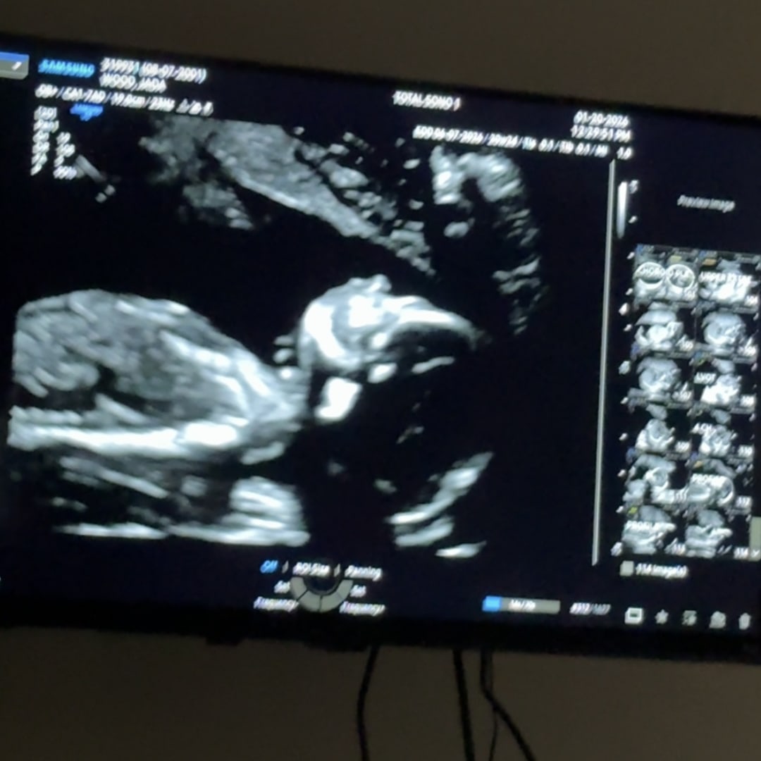 Photo shared by Jay for their Babylist baby registry.