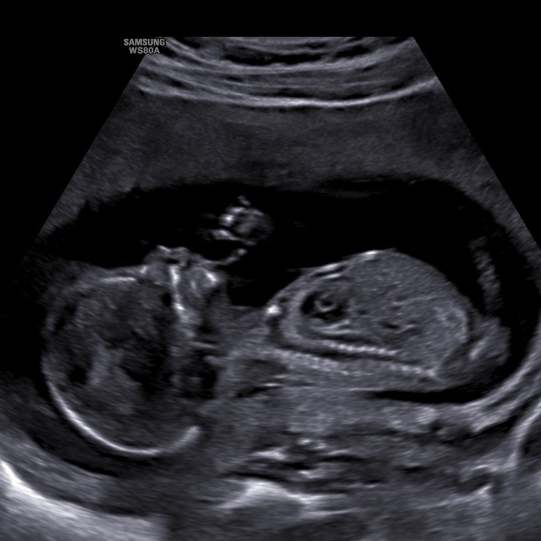 Photo shared by Ashley for their Babylist baby registry.