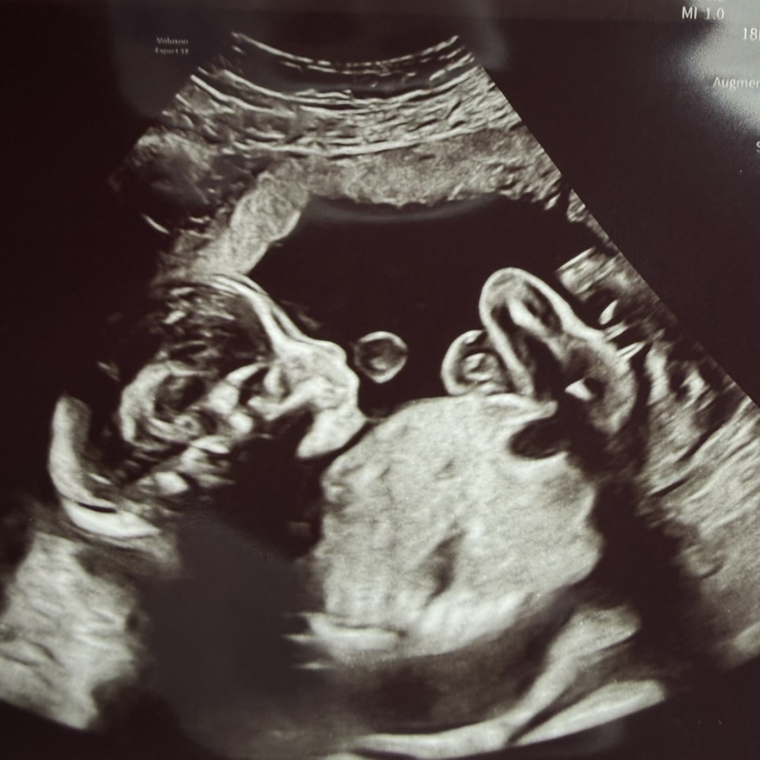 Photo shared by Chelsea for their Babylist baby registry.