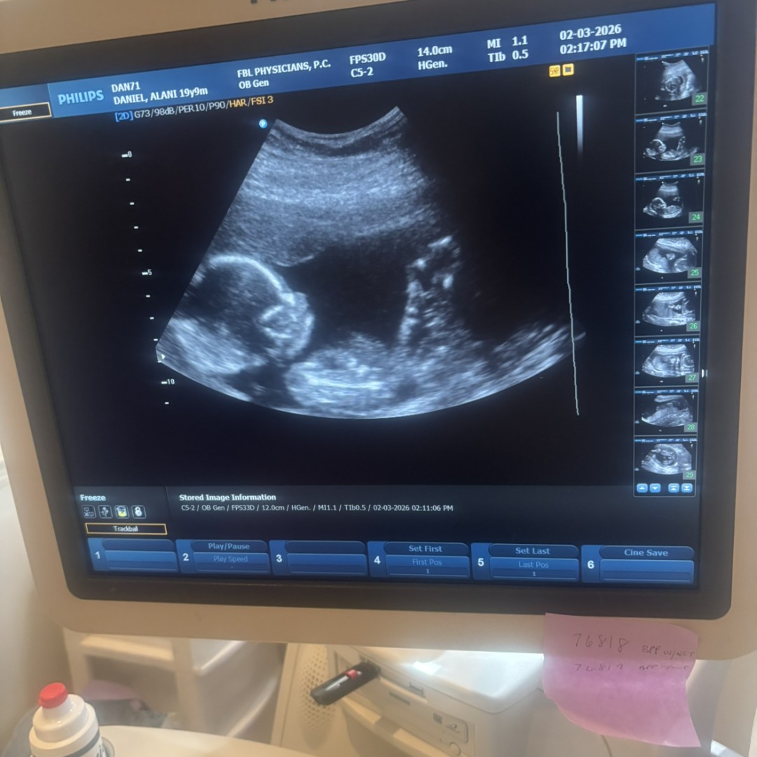 Photo shared by Nini for their Babylist baby registry.