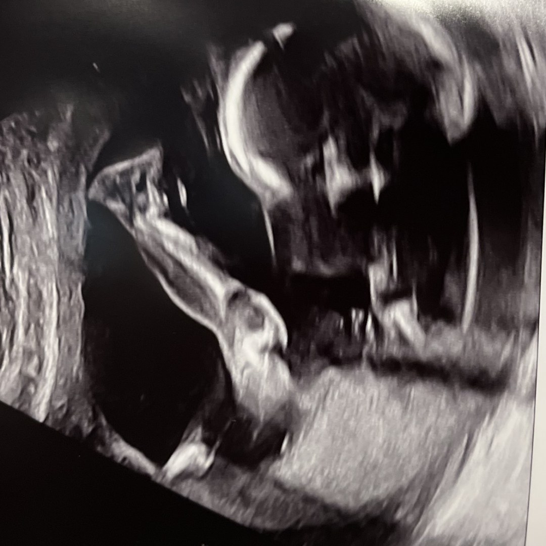 Photo shared by Jasmine for their Babylist baby registry.