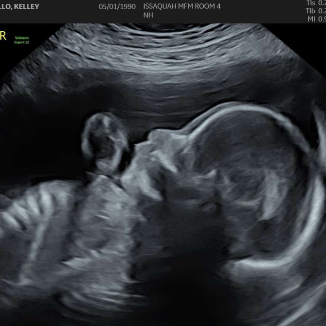 Photo shared by Kelley for their Babylist baby registry.