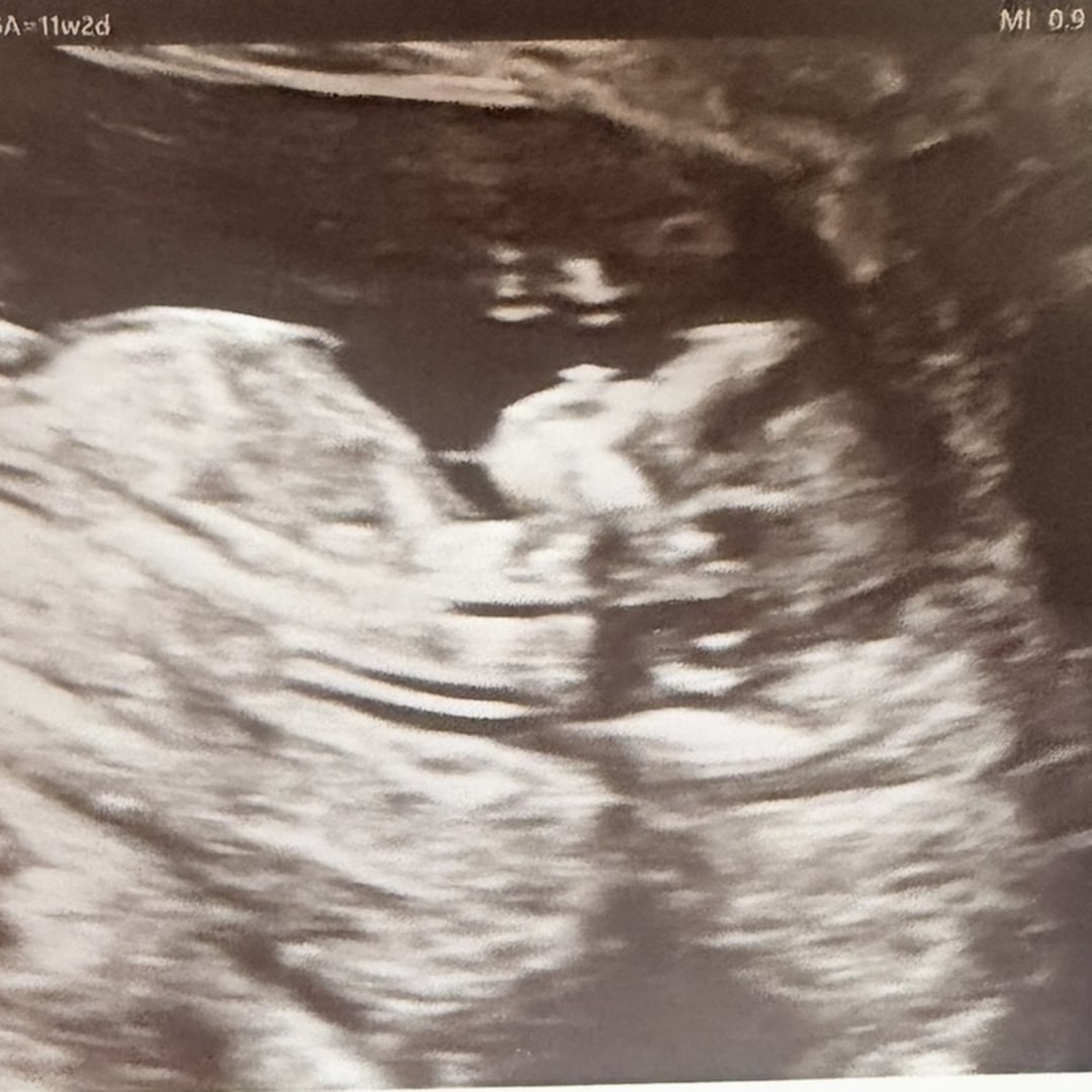 Photo shared by Cynthia for their Babylist baby registry.