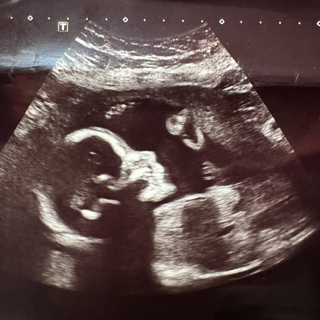 Photo shared by Shelby for their Babylist baby registry.
