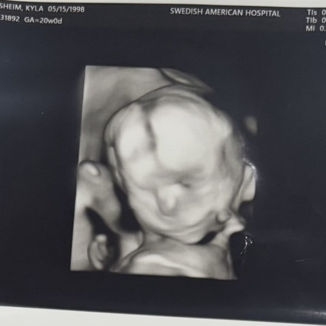 Photo shared by Kyla for their Babylist baby registry.