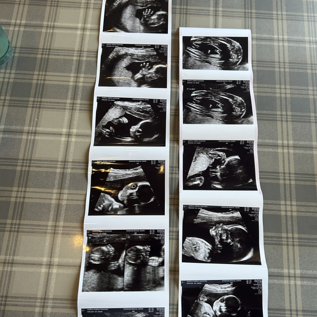 Photo shared by Robyn for their Babylist baby registry.