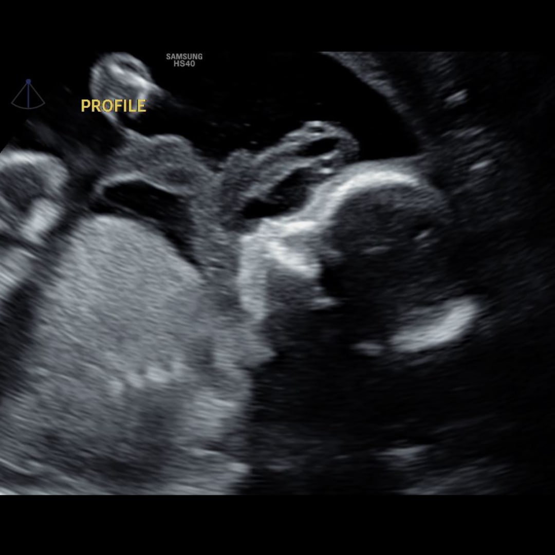 Photo shared by Allyson for their Babylist baby registry.