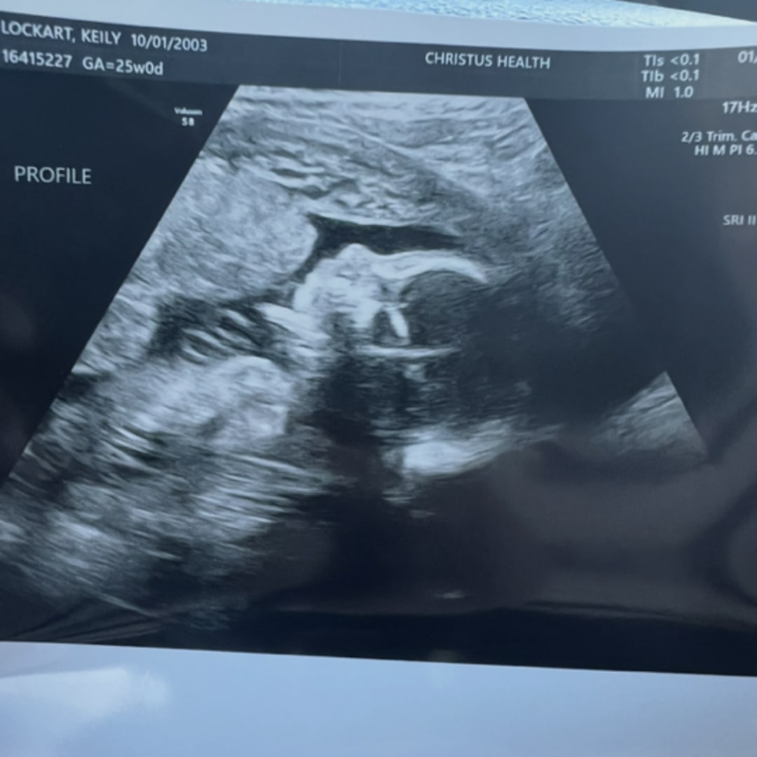 Photo shared by Keily for their Babylist baby registry.