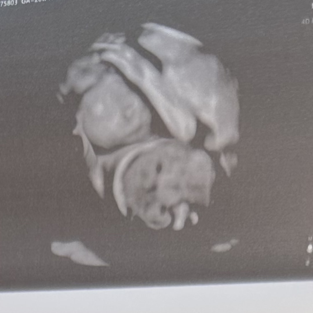 Photo shared by Hailey for their Babylist baby registry.