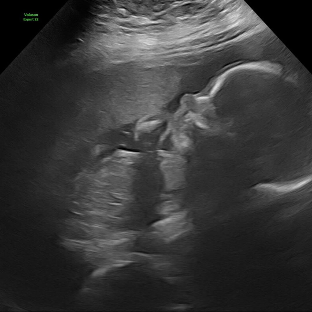 Photo shared by Jacklyn for their Babylist baby registry.