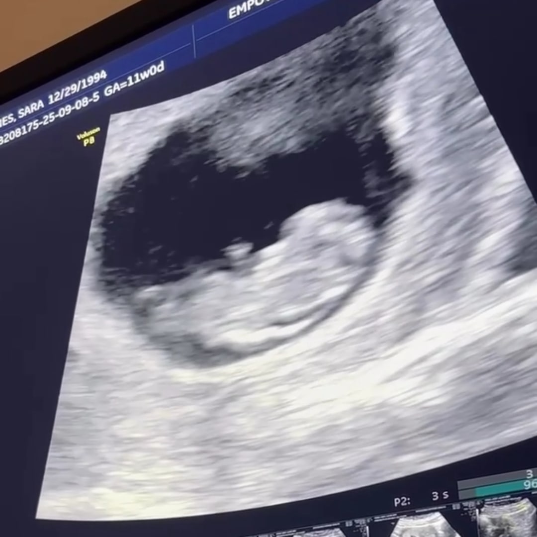 Photo shared by Jacob for their Babylist baby registry.