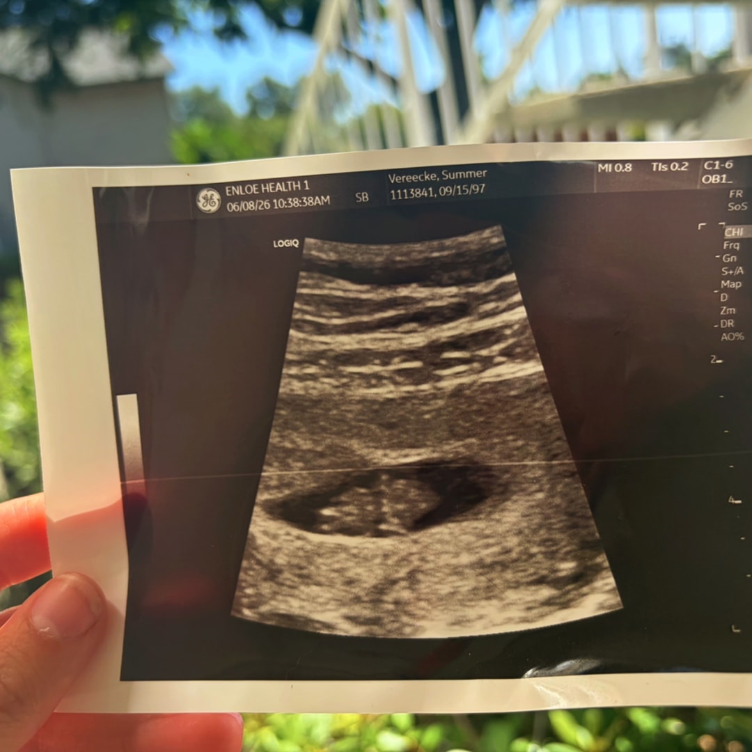 Photo shared by Summer for their Babylist baby registry.