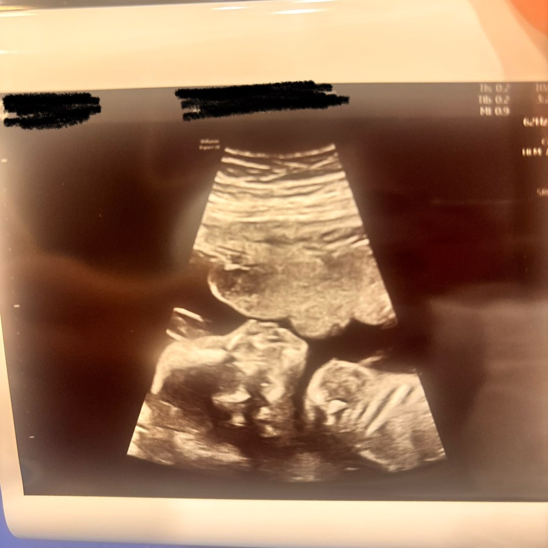 Photo shared by Ashley for their Babylist baby registry.