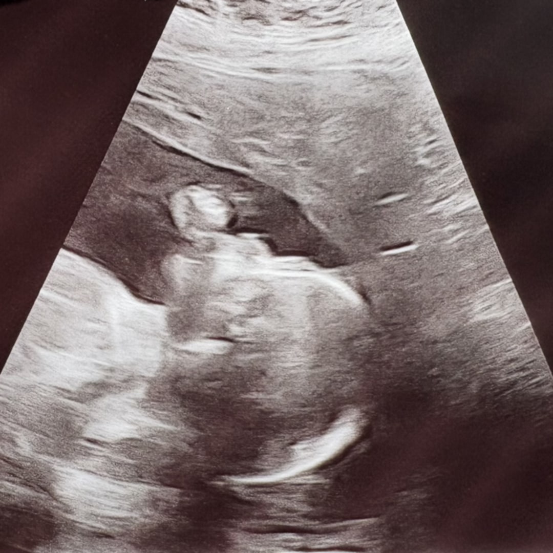 Photo shared by Hannah for their Babylist baby registry.