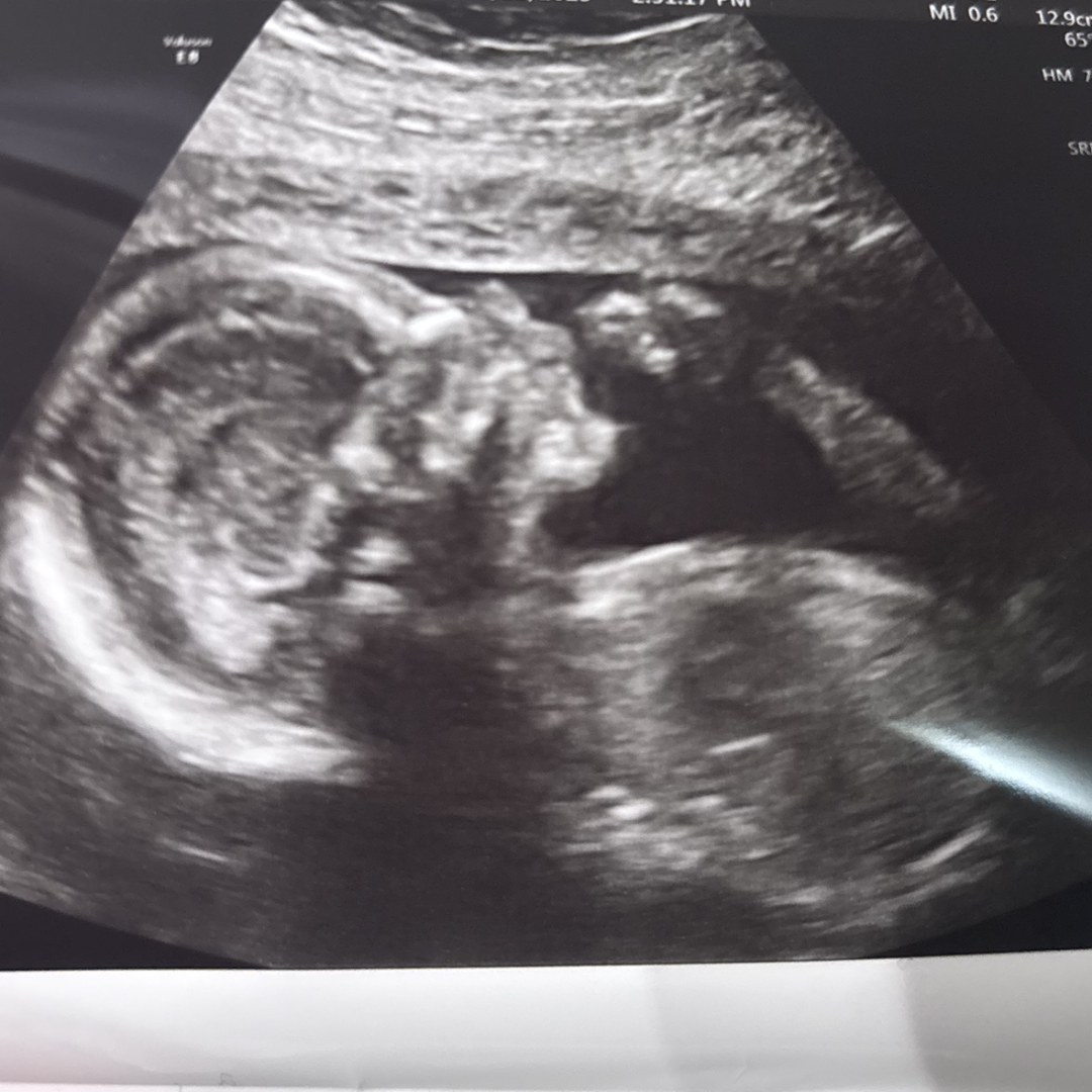 Photo shared by Cris for their Babylist baby registry.