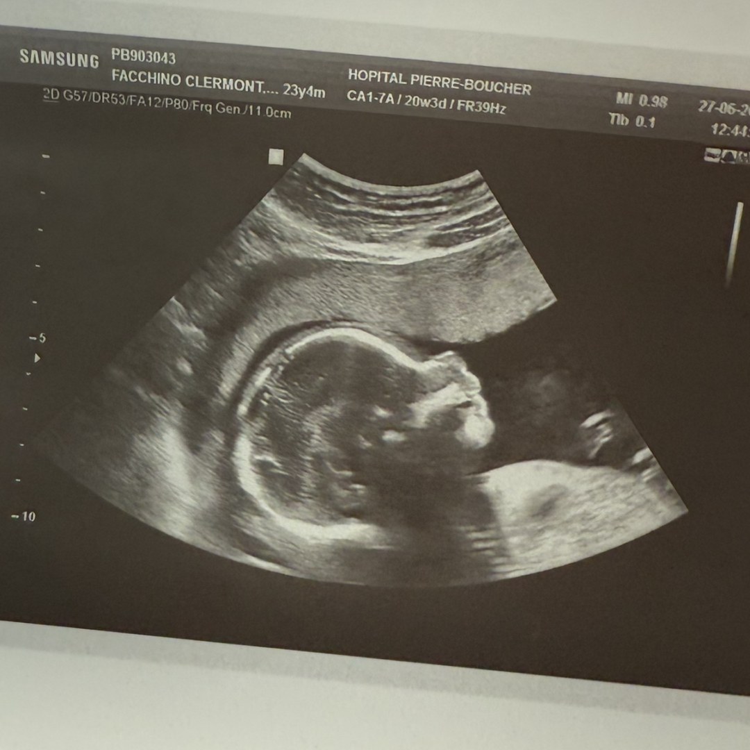 Photo shared by Cassandra for their Babylist baby registry.